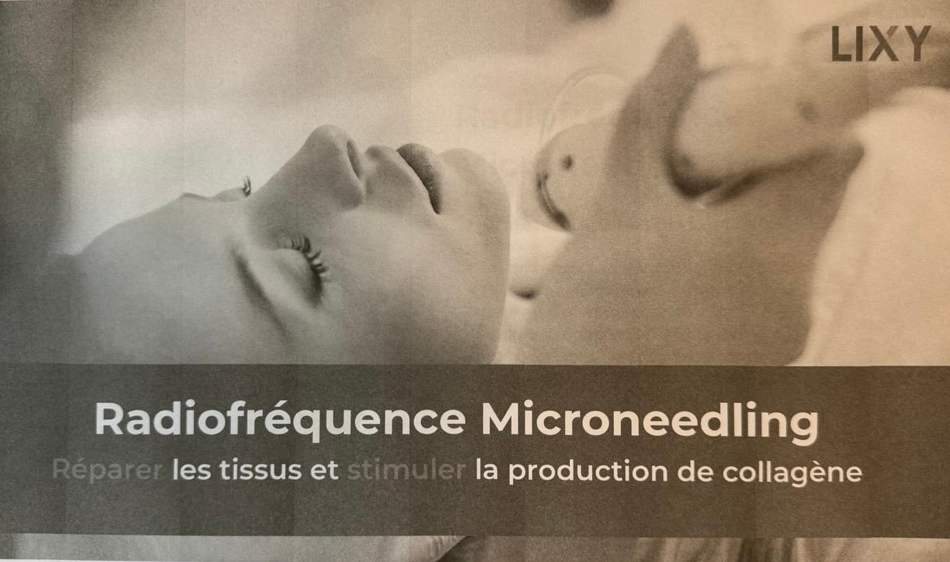 Radiofréquence Microneedling