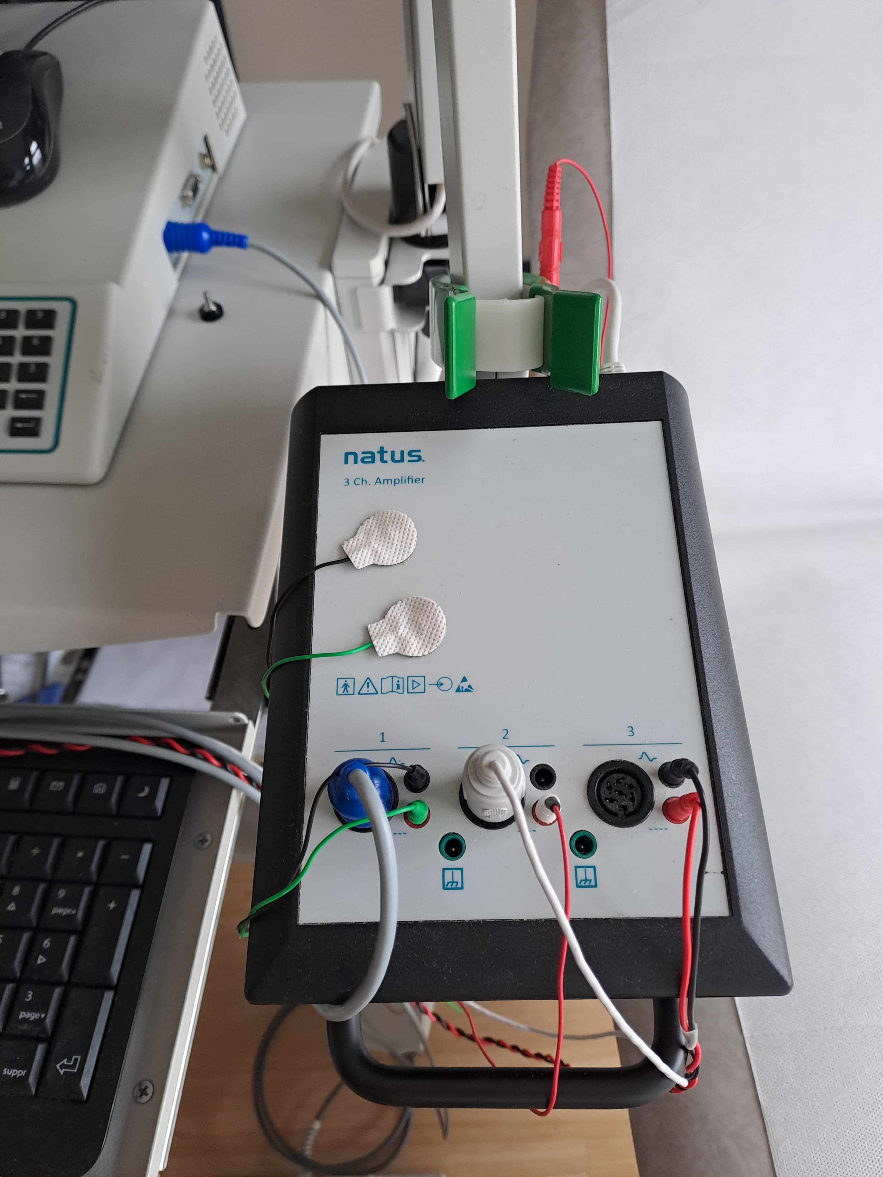 EMG Natus Keypoint