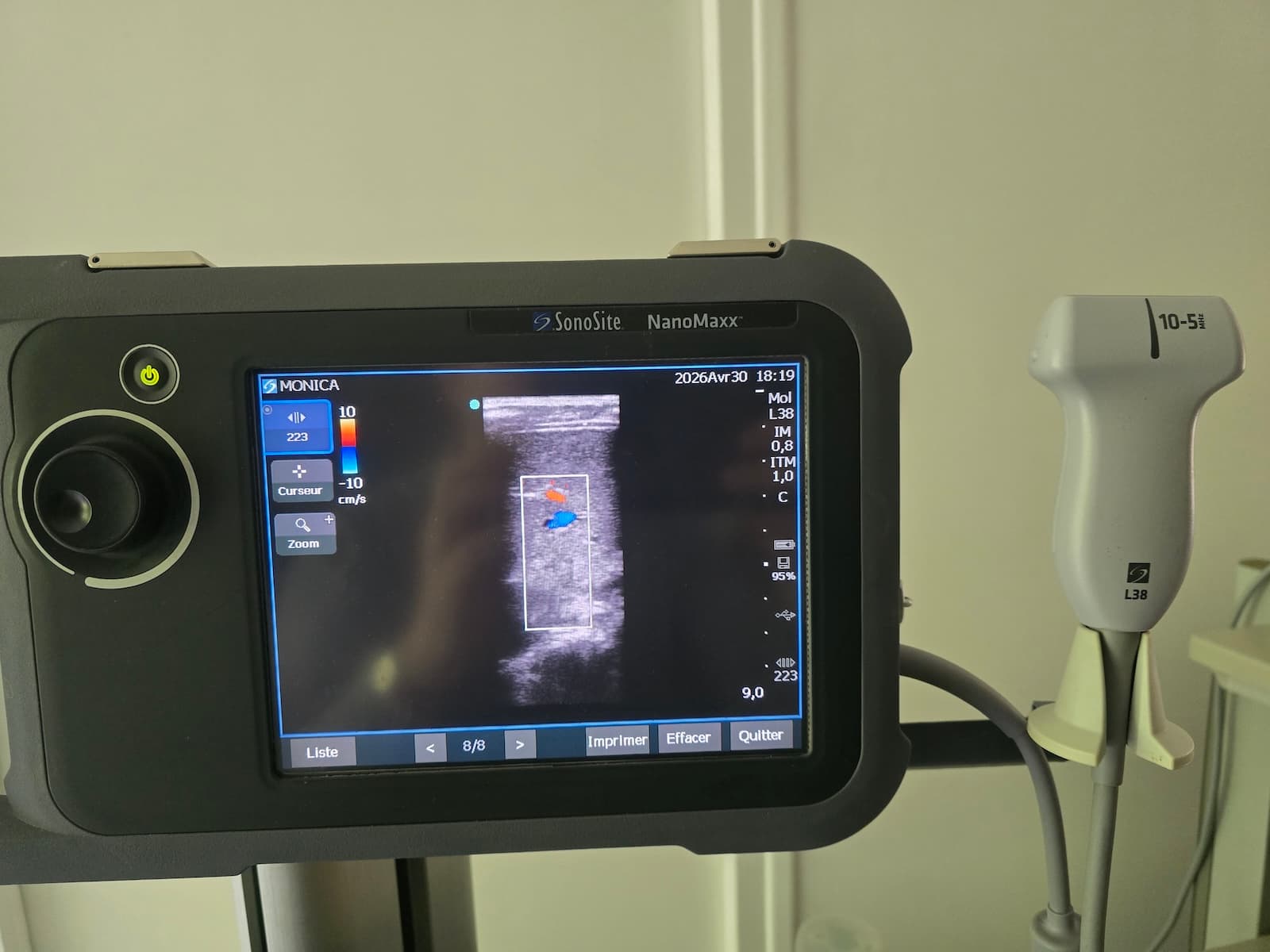 Échographe SonoSite NanoMaxx + sonde L38 + Doppler couleur – idéal kiné / sport / MSK