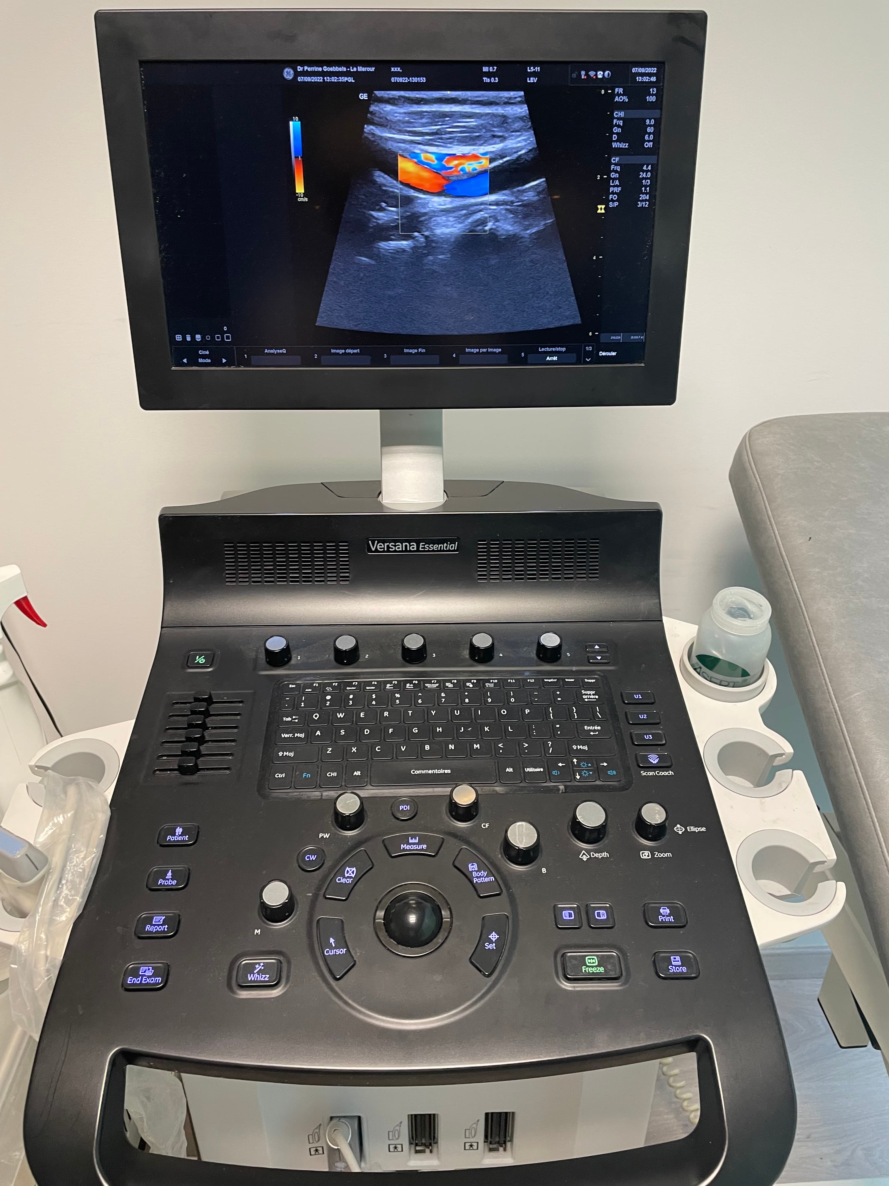 34 VD ECHODOPPLER GE HEALTHCARE