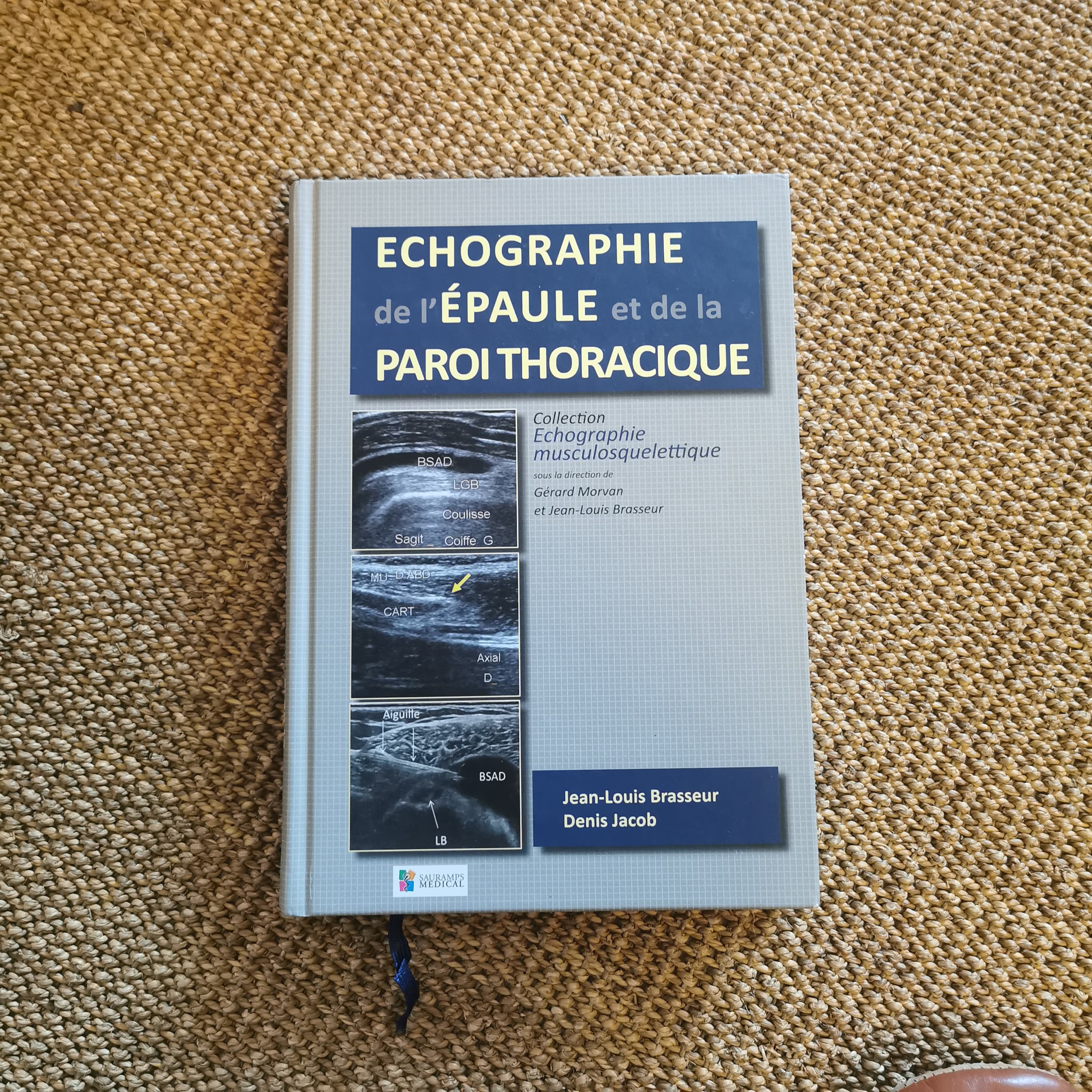 Echographie de l'épaule et de la paroi thoracique
