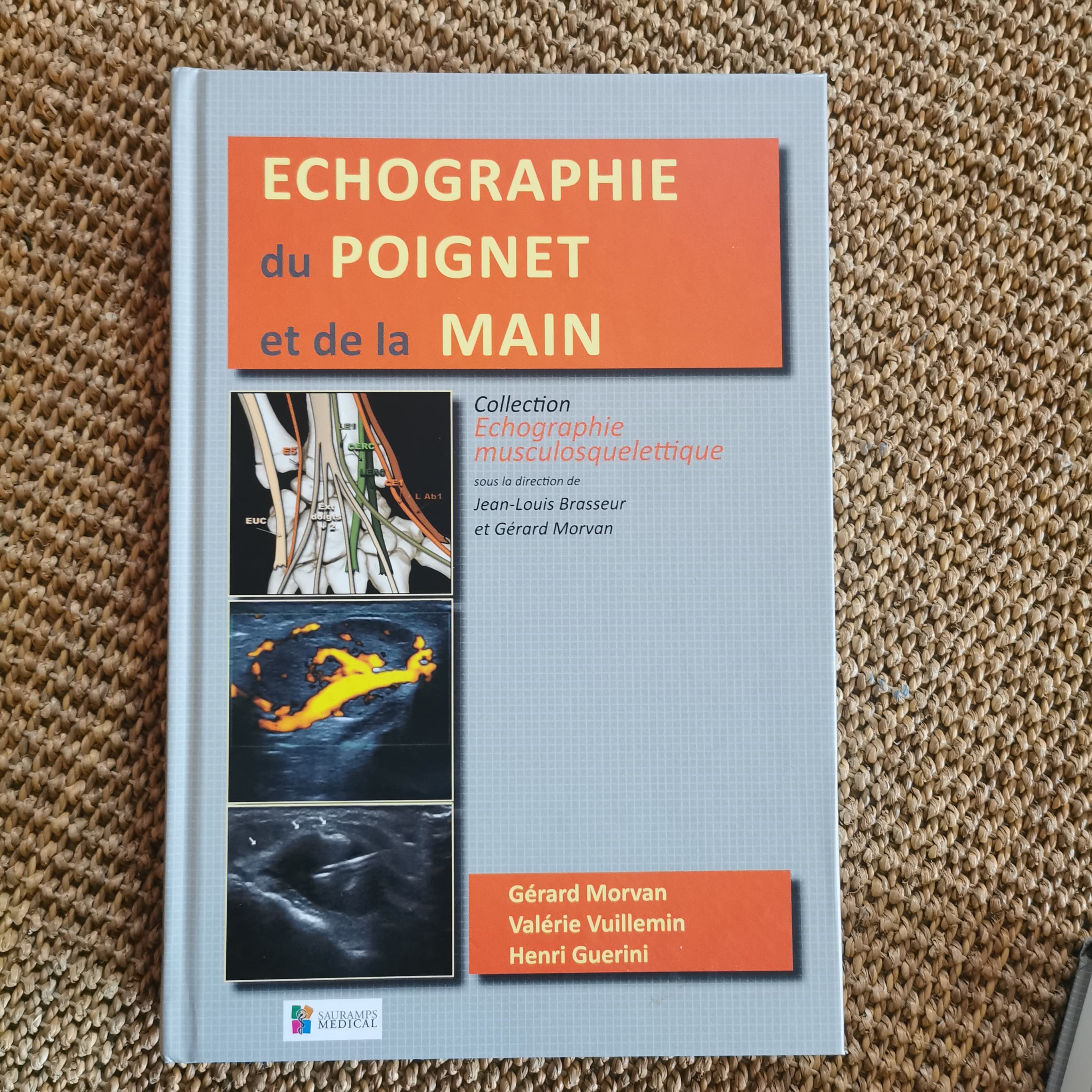 Echographie du poignet et de la main