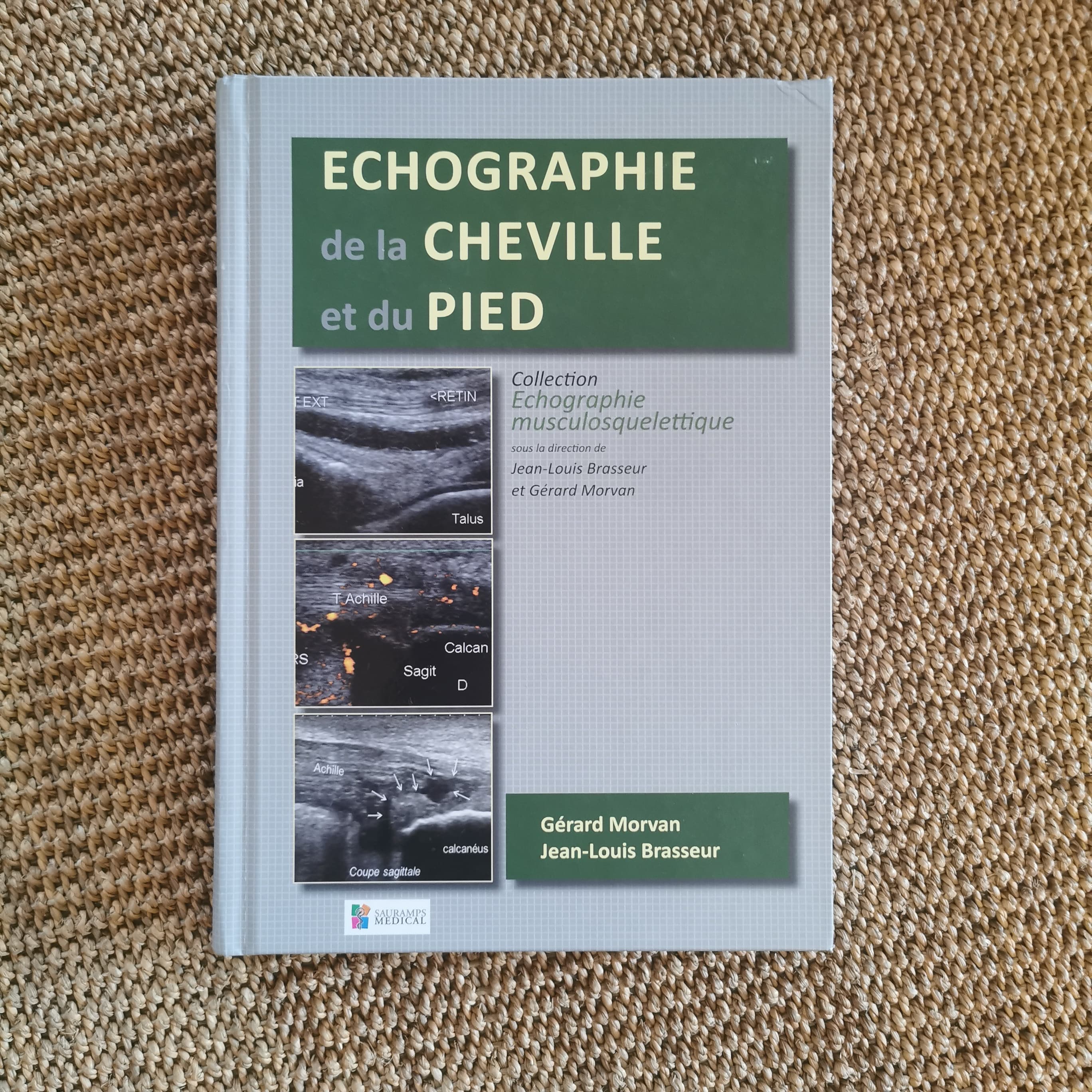 Echographie de la cheville et du pied
